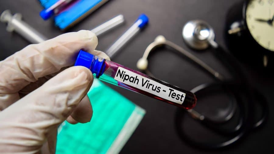 Authorities rule out significant Nipah virus threat to Uzbekistan