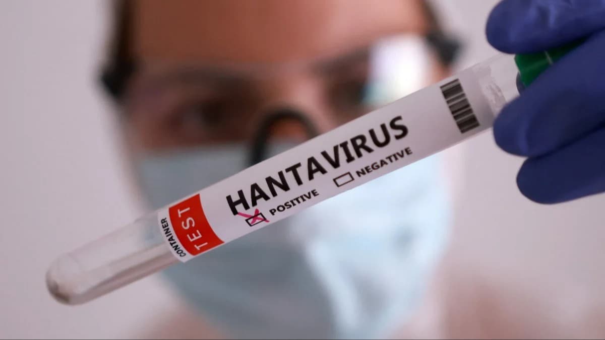 No Hantavirus cases recorded in Uzbekistan – Nurmat Otabekov