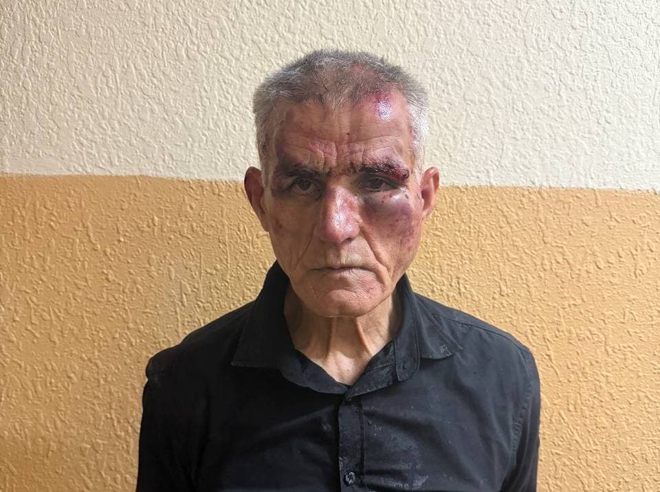 В Ташкенте психически больной мужчина ранил ножом сотрудника органов внутренних дел