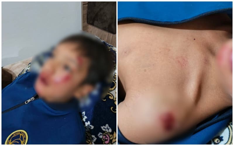 В Ташкенте третьеклассник оказался в больнице после стычки с учеником девятого класса