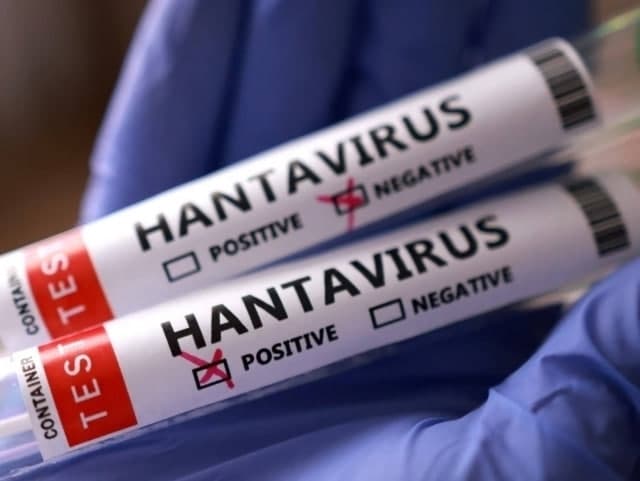 Hantavirus epidemiyasi yakunlanish arafasida - JSST