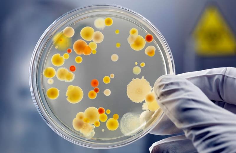 Davlat sanitariya-epidemiologiya nazorati markazi botulizm kasalligi bo‘yicha eslatma bilan chiqdi
