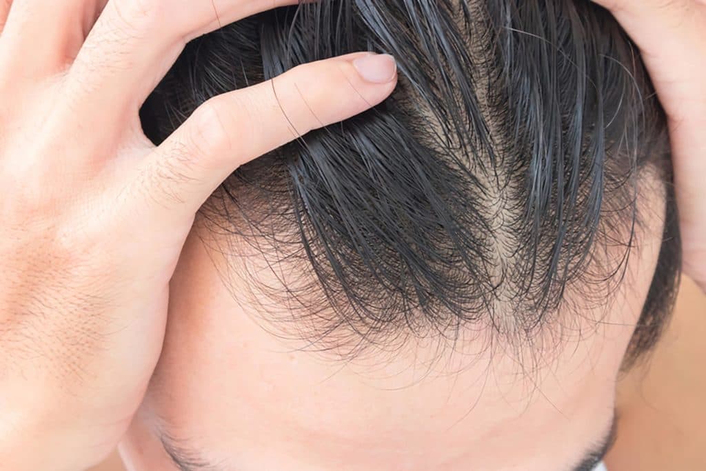 Soch uchun mo‘jiza- Hair Magic kukuni!