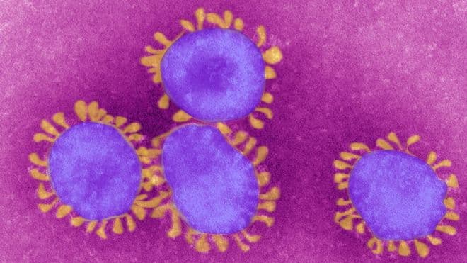 Epidemiya ko‘lami. Koronavirusdan zararlanganlar soni o‘n barobar ko‘proq bo‘lishi mumkin