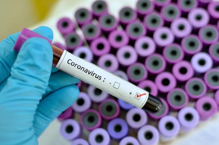 Koronavirus qanday haroratda tarqalmasligi ma'lum qilindi