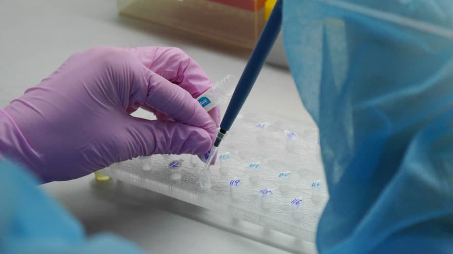 O‘zbekistonda koronavirus uchun ommaviy test qilinmayotganiga izoh berildi