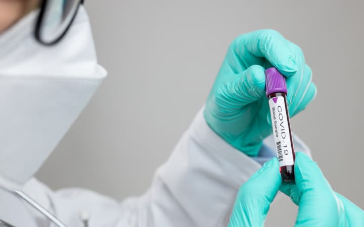 Namanganda virus aniqlangan ilk bemor bilan aloqada bo‘lgan 54 kishi izolyatsiya qilindi