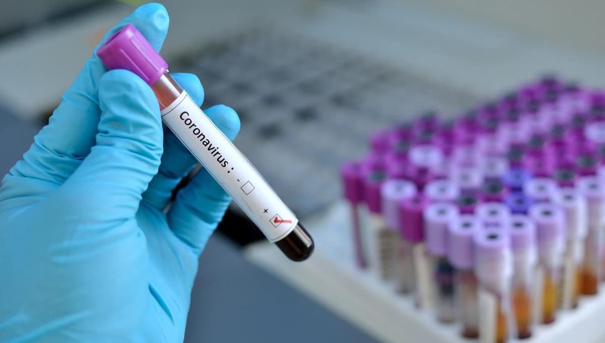 Giyohvandlik vositasini sotgan shaxs koronavirus tufayli qamoqqa emas, karantinga olindi