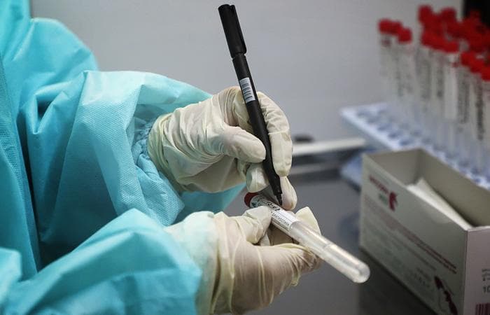 В Узбекистане за сутки выявили 316 случаев коронавируса