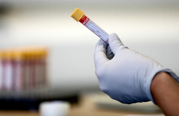 Dunyo bo‘ylab koronavirus infeksiyasini yuqtirib olganlar soni 7 milliondan oshdi