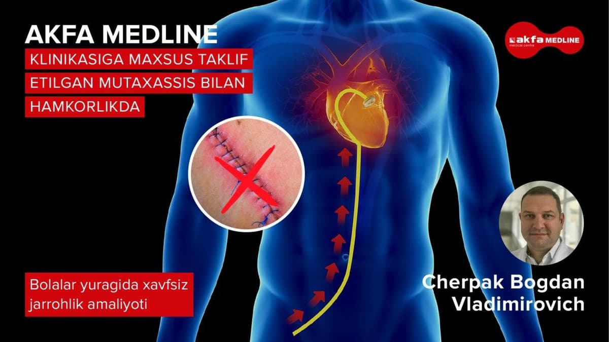 AKFA Medline клиникасида болаларда туғма юрак нуқсонларини хавфсиз усул билан даволаш амалиёти ўтказилмоқда