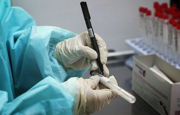 В Узбекистане за сутки выявили 304 случая коронавируса