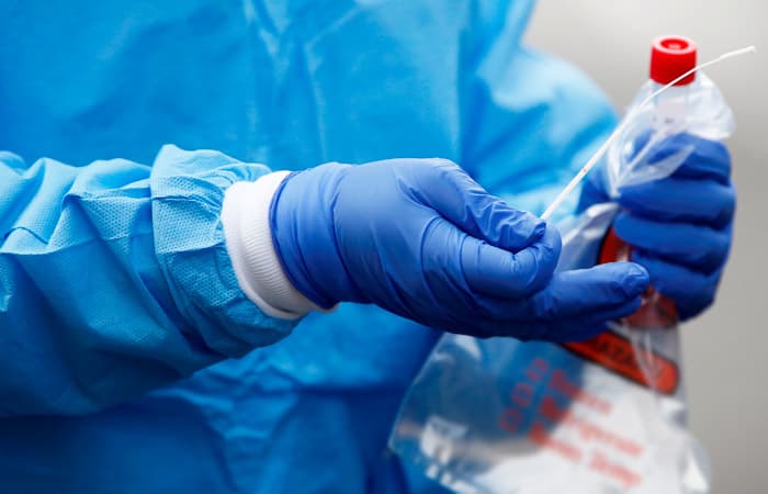 В Узбекистане имеется резерв на 200 тыс. тест-систем для выявления коронавируса