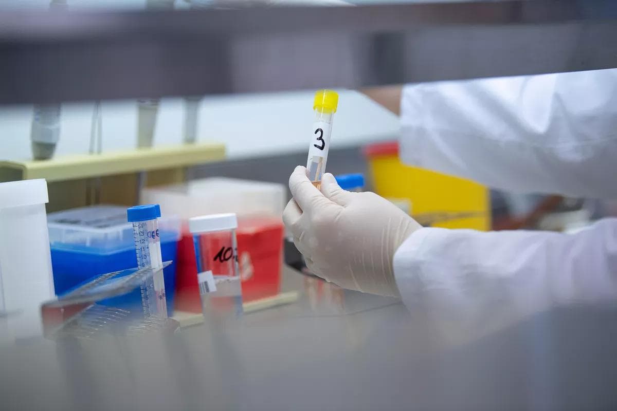 Koronavirus xavflilik darajasi bo‘yicha boshqa viruslar bilan taqqoslandi