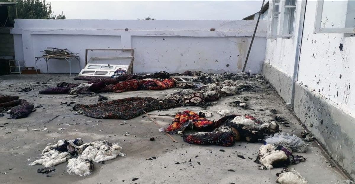 Kattaqo‘rg‘onda yuz bergan gaz portlashi haqida qo‘shimcha ma'lumot berildi. Qozog‘istonlik mehmon 50 foizga kuygan
