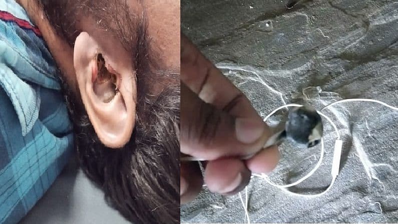 Hindistonda Bluetooth-quloqchin portlashi inson o‘limiga sabab bo‘ldi