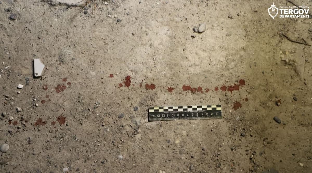 18 yoshli yigit haydovchiga pichoq bilan hujum qildi