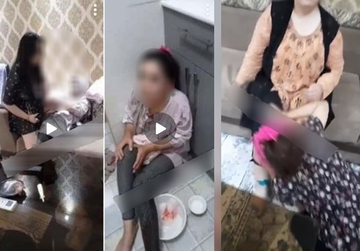 Тошкентда хонадон эгаси имконияти чекланган хизматкор аёлни калтаклади