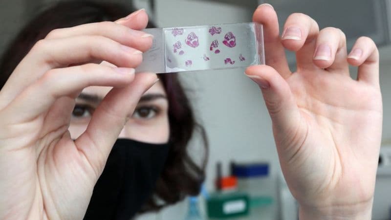 Olimlar koronavirusni boshdan kechirganlarda umrbod immunitet shakllanishi mumkinligini aytishmoqda