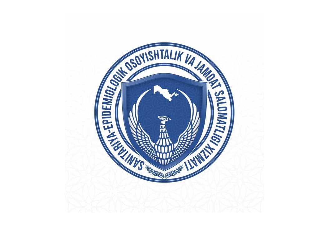 SES Toshkentda kuydirgi qayd etilmaganini ma’lum qildi