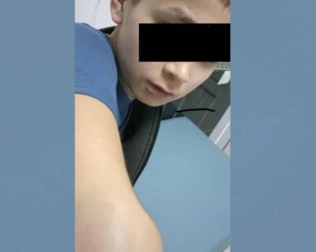 В одном из домов милосердия в Ташкенте мужчина-воспитатель избивал мальчика