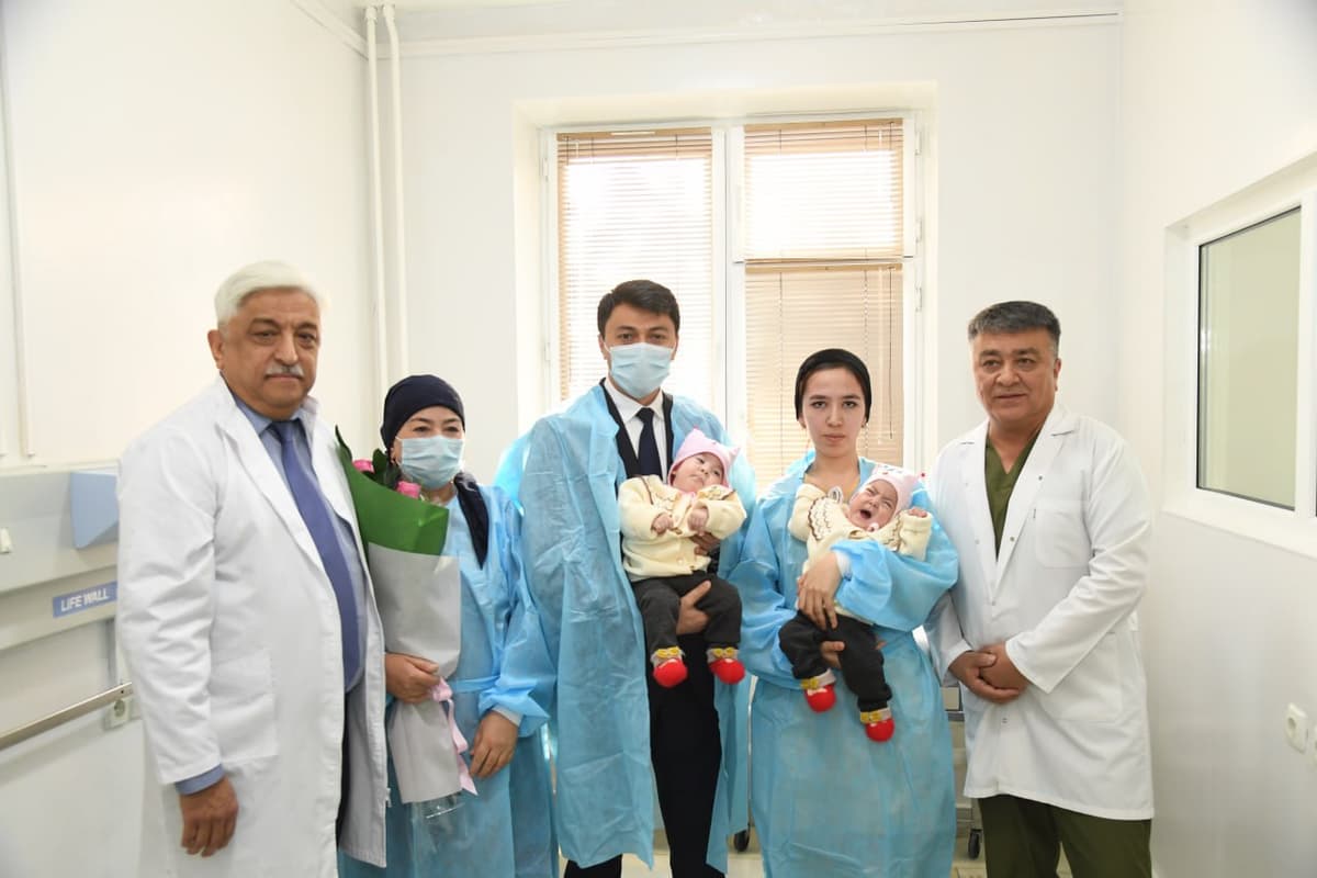 Uzbek doctors separated Siamese twins for the first time