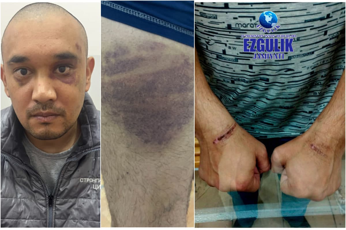 Ikki erkak tergov jarayonida qiynoqqa solingani aytilmoqda. IIV munosabat bildirdi