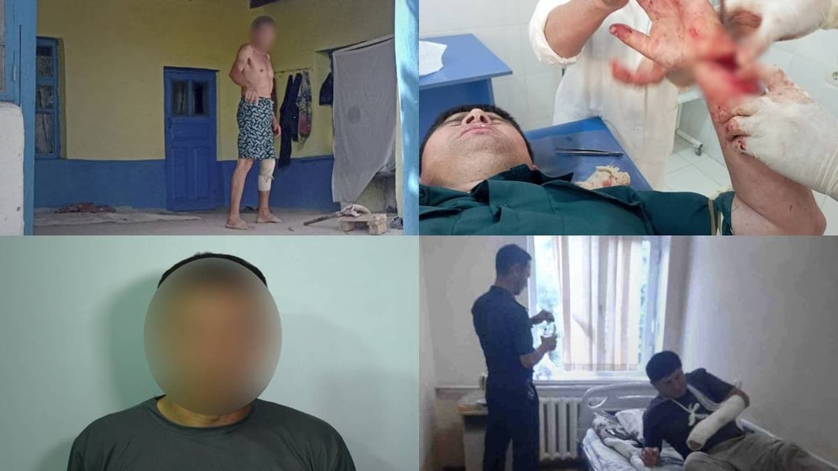 Sariosiyoda 47 yaşar erkak “uçastkavoy”ni bolta bilan jarohatladi