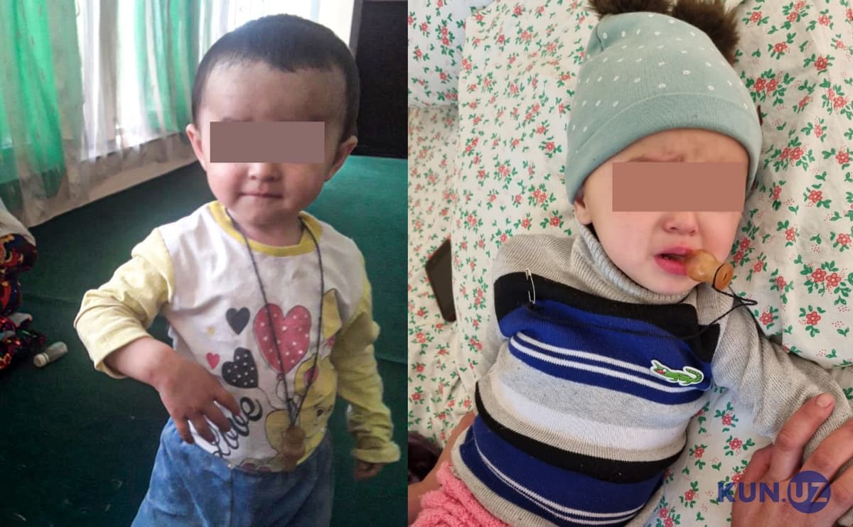 Qashqadaryoda ikki yoshli qizaloq noto‘g‘ri emlangani sabab falaj bo‘lib qolgani aytilmoqda