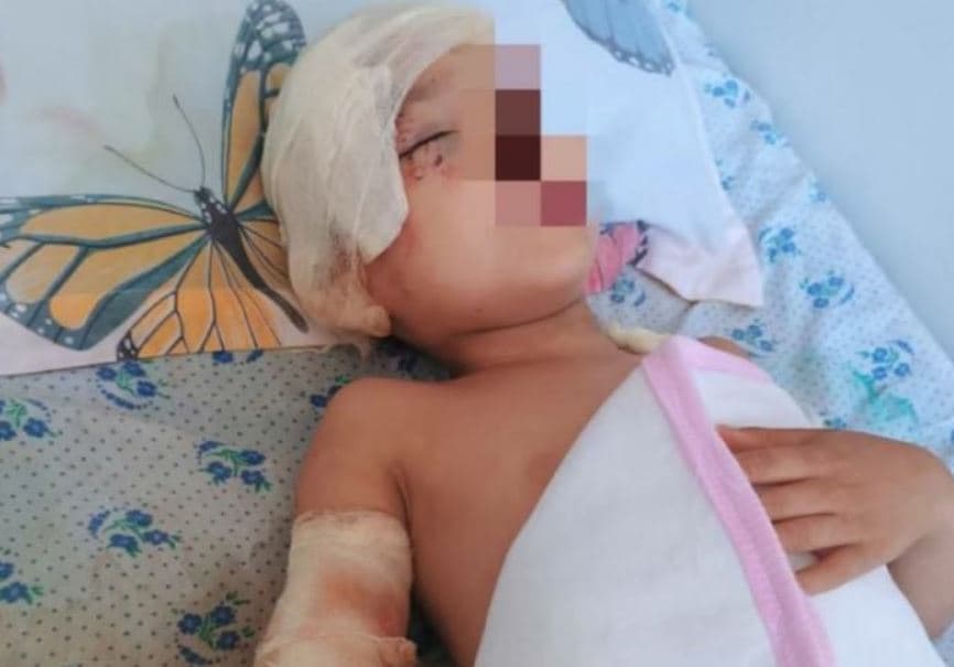 Стая собак напала на 5-летнего ребенка в Андижанской области