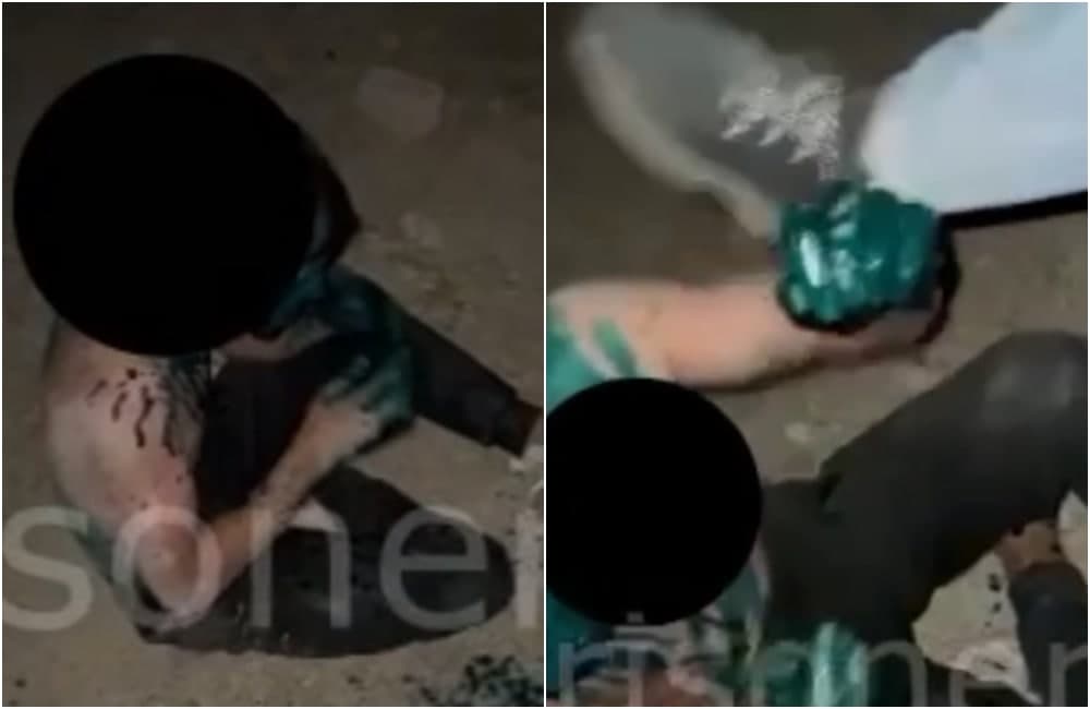 Toshkentda 19 yashar yigitni kaltaklab, ustiga “zelyonka” sepganlar ushlandi